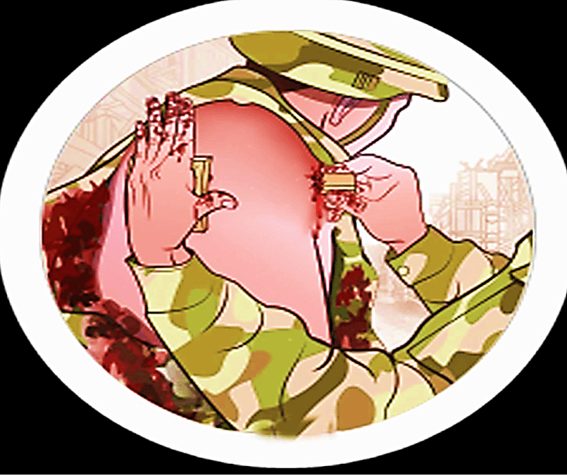 Trauma context